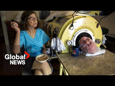 ‘Iron Lung Man’ dies at 78 after more than 70 years of paralysis from polio