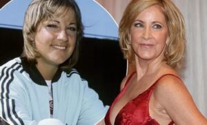 Chris Evert Plastic Surgery