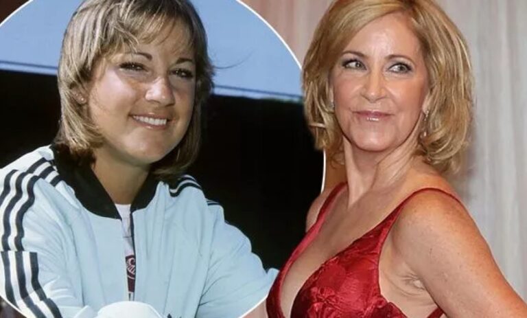 Chris Evert Plastic Surgery