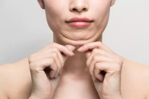 How To Get Rid Of Neck Fat
