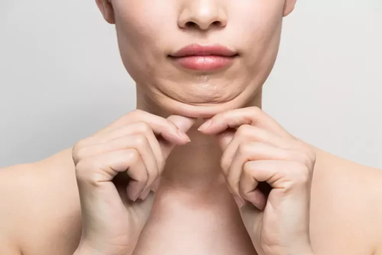 How To Get Rid Of Neck Fat