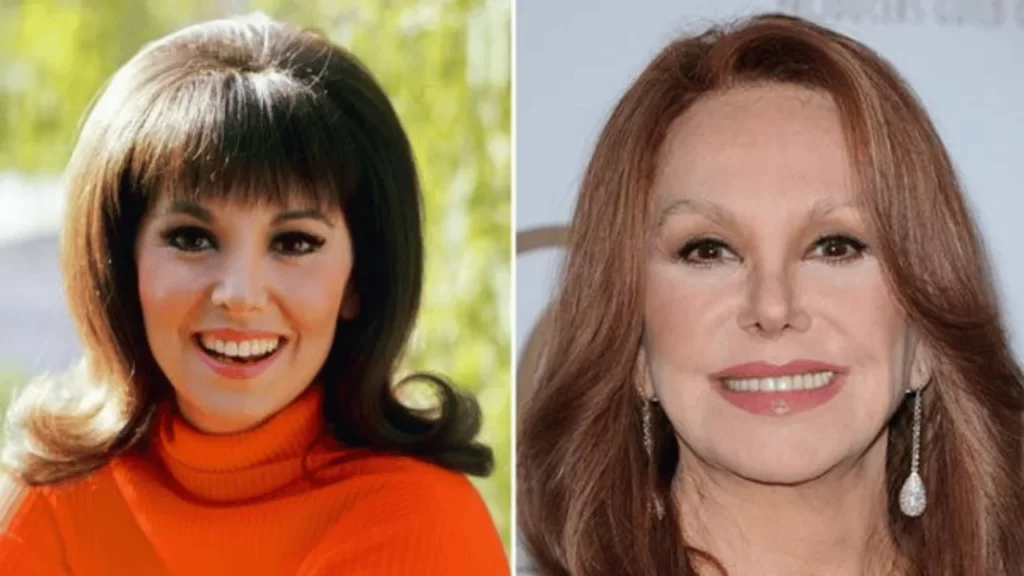 What Happened To Marlo Thomas’s Face
