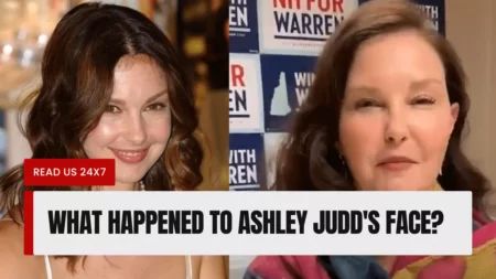 What Happened To Ashley Judd’s Face