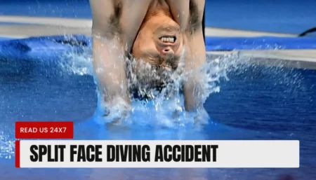 Split Face Diving Accident