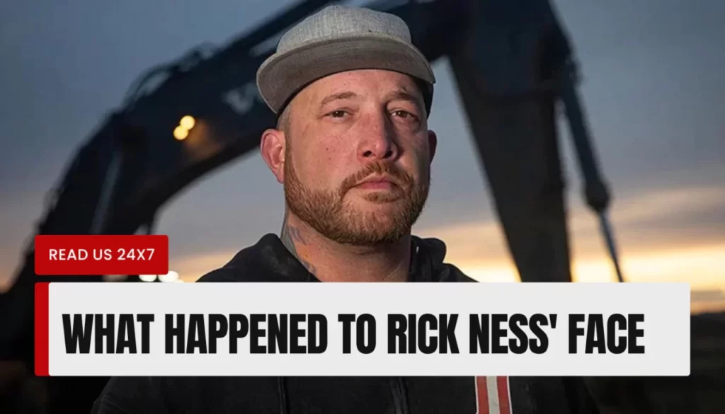 What Happened To Rick Ness' Face