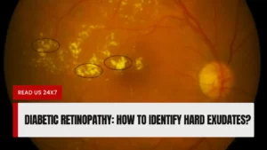 Diabetic Retinopathy Hard Exudates