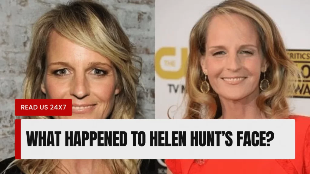 What Happened To Helen Hunt’s Face