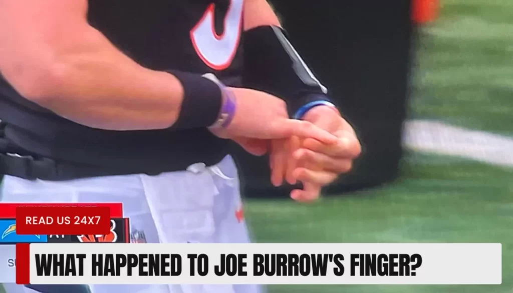 What Happened To Joe Burrow's Finger