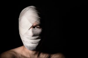 Degloved Face Injuries