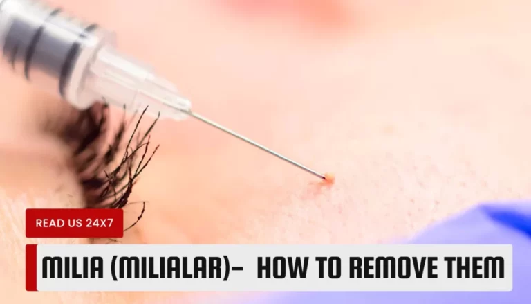 Milialar