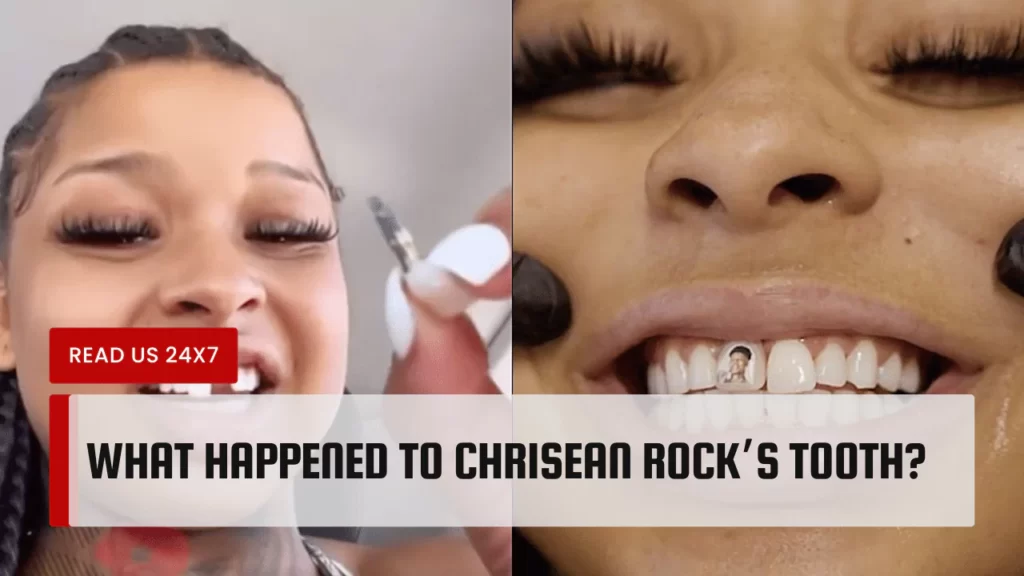 What Happened To Chrisean Rock’s Tooth