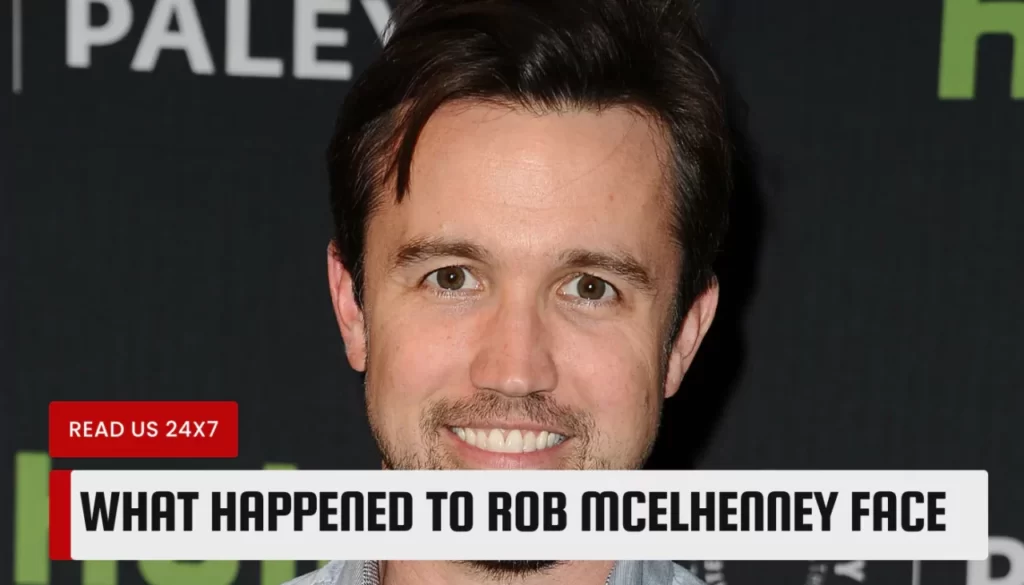 What Happened to Rob McElhenney Face
