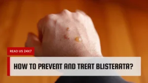 How To Prevent And Treat Blisterata