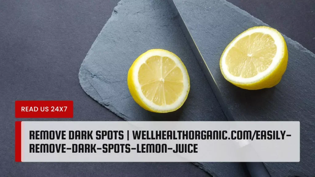 Remove Dark Spots | wellhealthorganic.com/easily-remove-dark-spots-lemon-juice