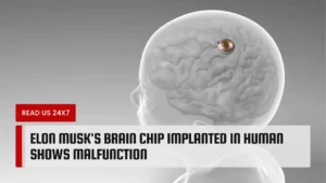 Elon Musk's Brain Chip Implanted in Human Shows Malfunction