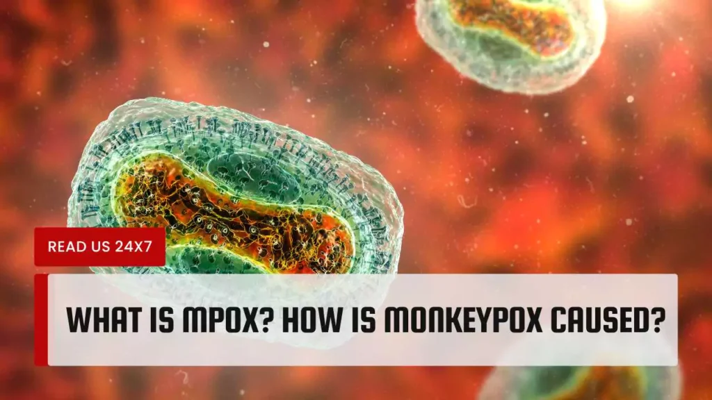 What is Mpox